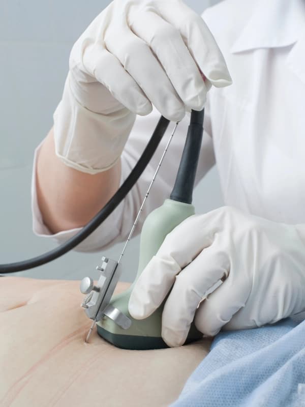 invasive diagnostik